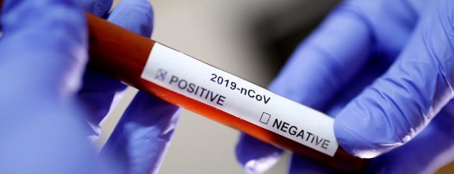HES: U Gradačcu na koronavirus testirano 537 osoba